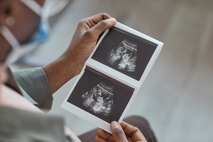 Prenatal ultrasounds